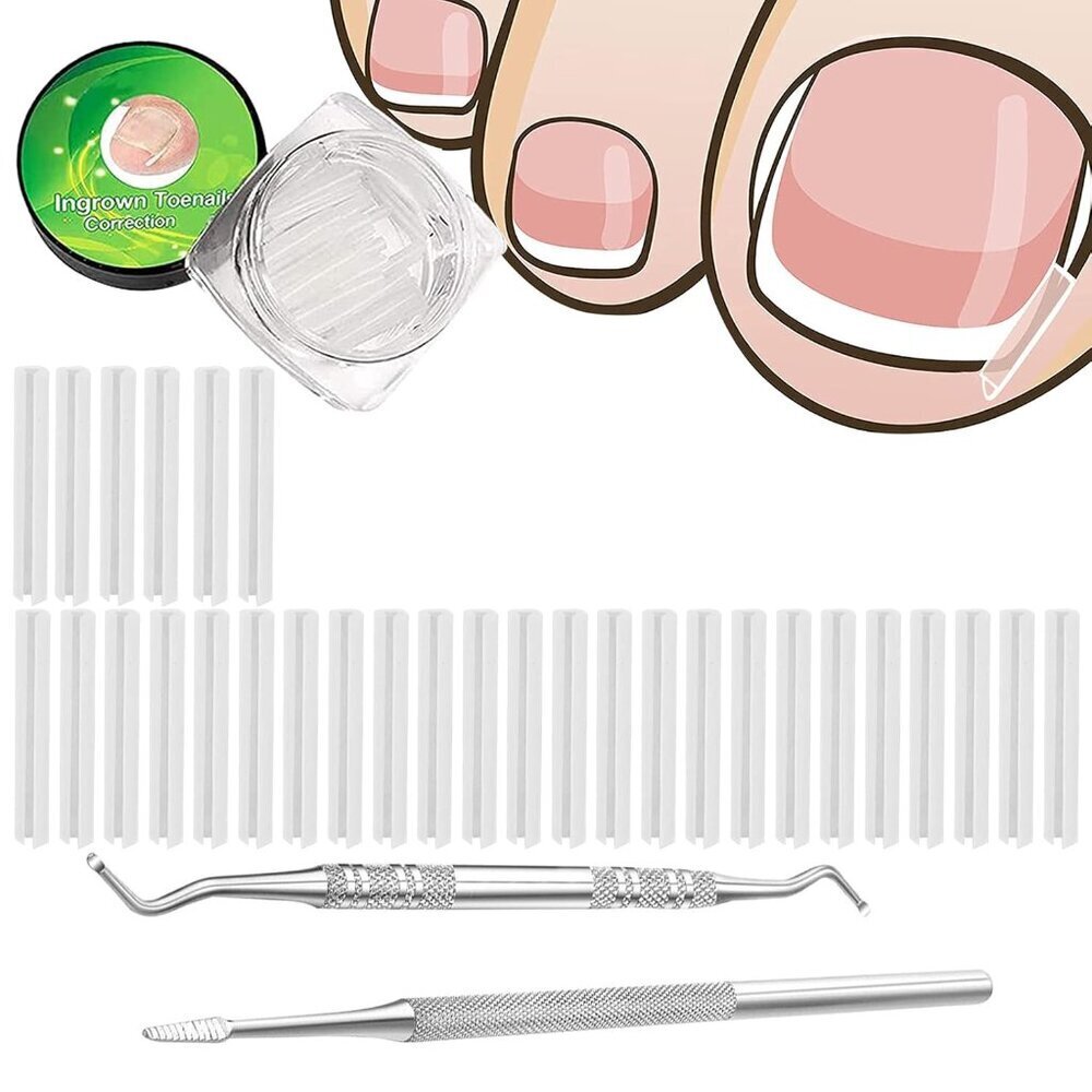 30+2 Pack Kit, 30PCS Ingrown Toenails Corrector Strips Brace Ingrown Toenail Ped